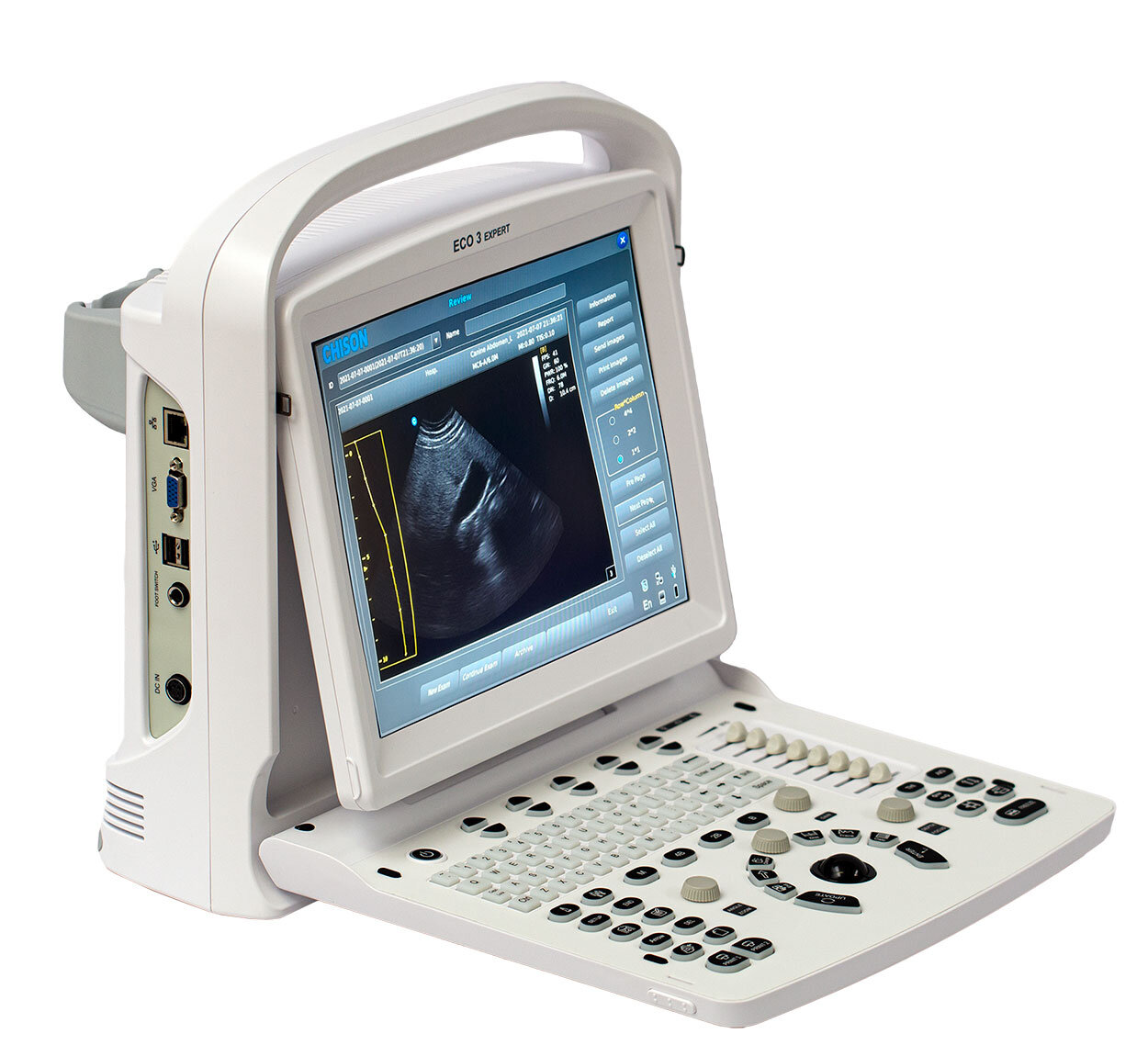 Chison Eco 3 Expert - Lightweight Portable Veterinary X-Ray